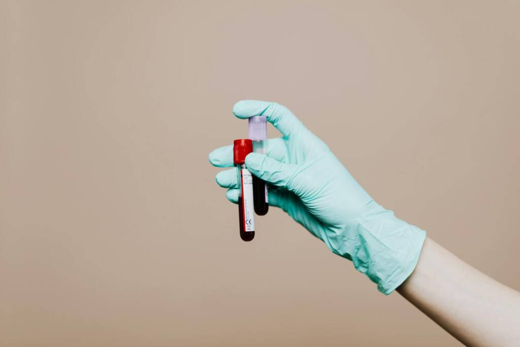 TRT Blood Work Explained - What Your Testosterone Labs Actually Mean