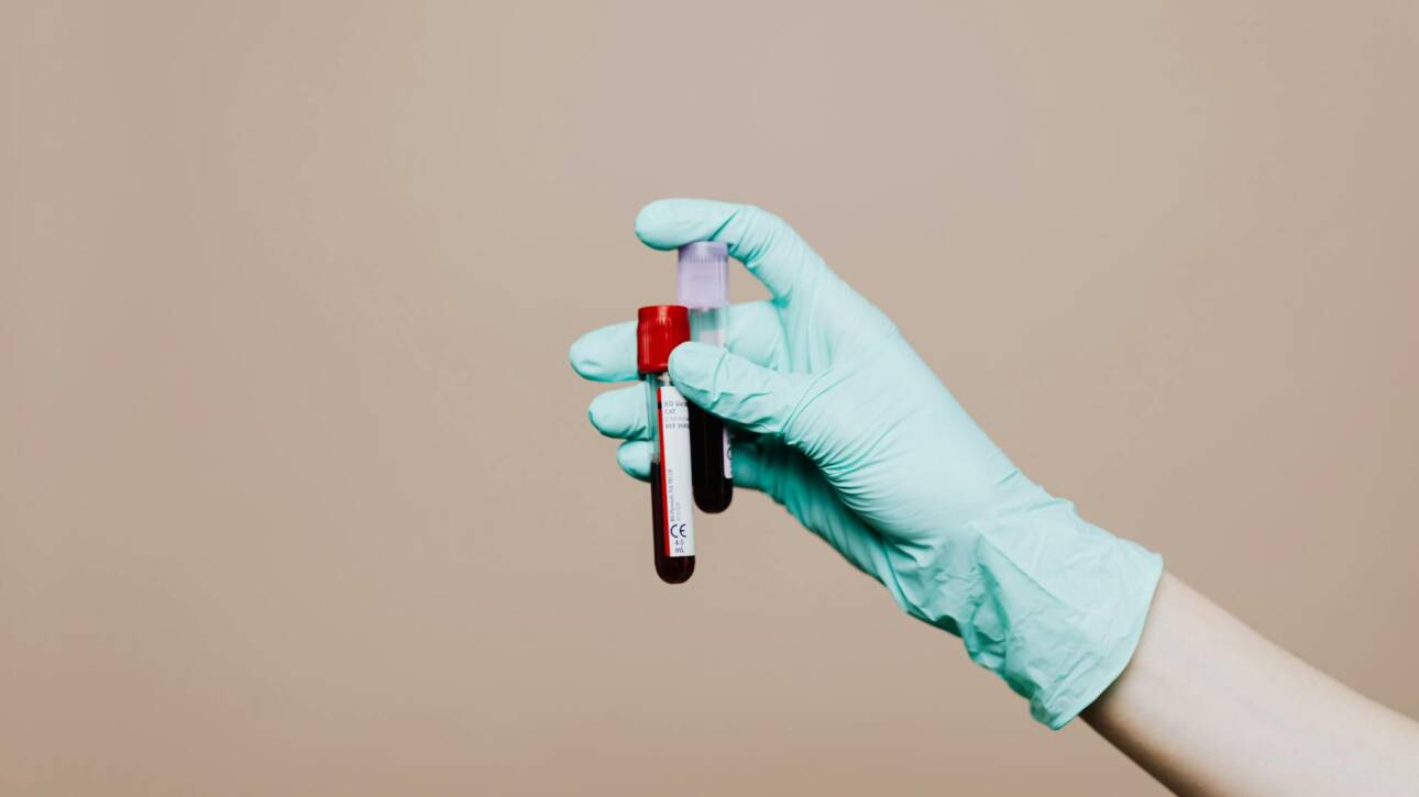 TRT Blood Work Explained - What Your Testosterone Labs Actually Mean
