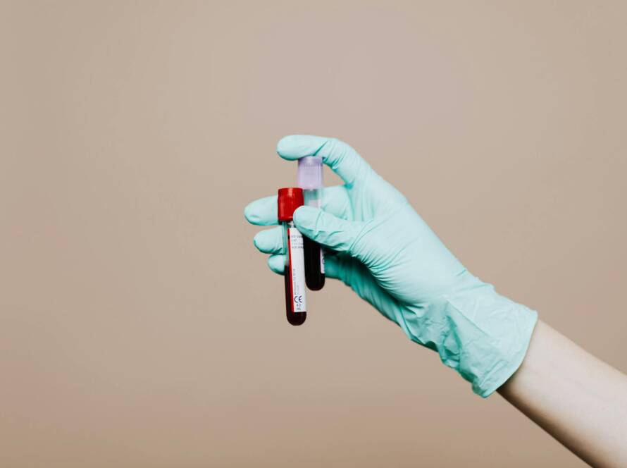 TRT Blood Work Explained - What Your Testosterone Labs Actually Mean