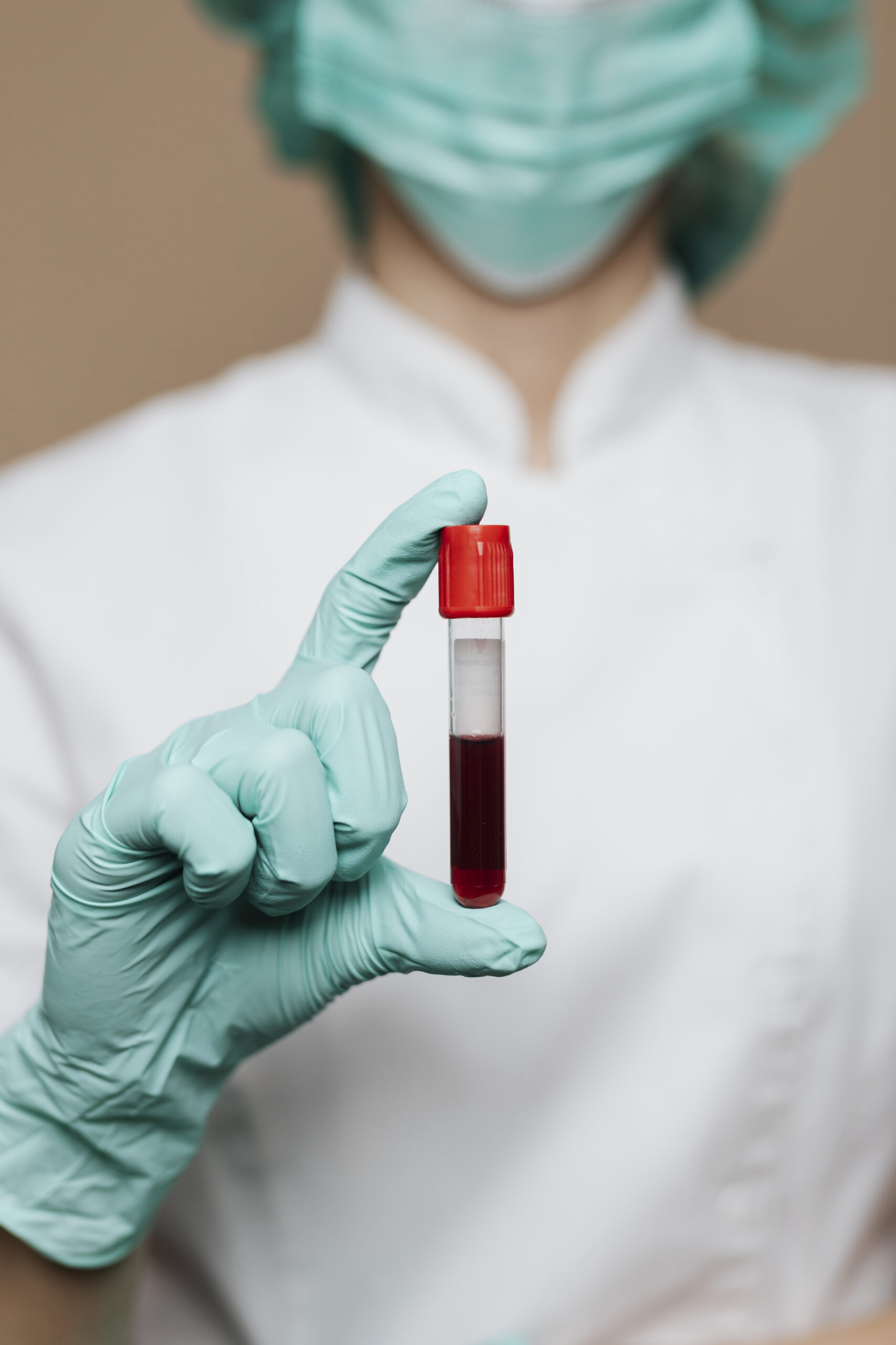 Blood test sample used when estimating TRT costs in Colombia