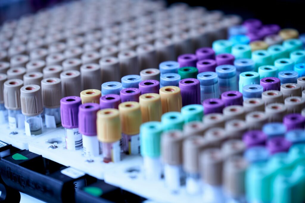 Testosterone Blood Tests - When to Test, Whether to Fast, and How TRT Changes the Rules