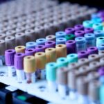 Pruebas de Sangre de Testosterona - Cuándo Probar, Si Ayunar, y Cómo TRT Cambia las Reglas Testosterone Blood Tests - When to Test, Whether to Fast, and How TRT Changes the Rules