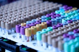Testosterone Blood Tests - When to Test, Whether to Fast, and How TRT Changes the Rules